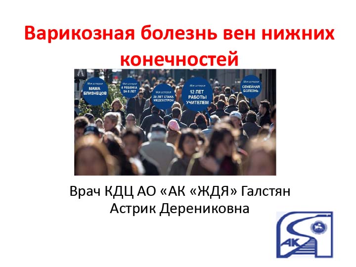 Варикозная болезнь вен нижних конечностей